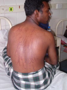 Torture victim - Sri Lanka | File foto